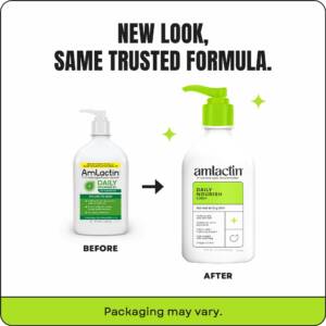 AmLactin® Daily Moisturizing Body Lotion- 7.9oz (12% Lactic Acid) Packing may vary