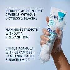 Cerave Acne Foaming Cream Wash 10% Benzoyl Peroxide